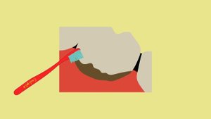 Как очистить зубной камень