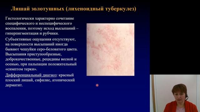 Дерматовенерология 4.Туберкулёз кожи