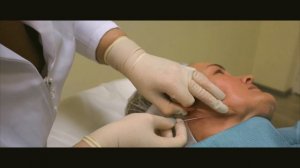 Нитевой лифтинг шеи и подбородка Resorblift