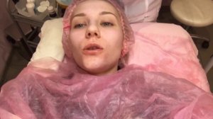 ХИМИЧЕСКИЙ ПИЛИНГ ДЖЕССНЕРА