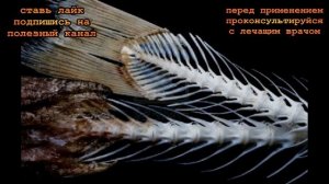 ★ Правильные первые действия при застревании рыбной кости в горле. Опасные и неэффективные способы