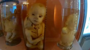 Ужасы кунсткамеры / Спб