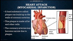 Class 7 | Science | Chapter 2 | The heart attack | By Excel School