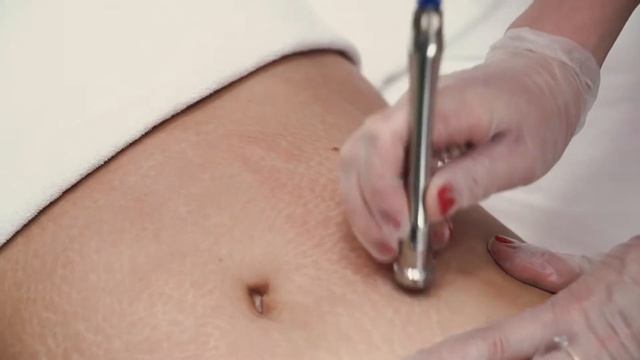 Алмазный пилинг в салоне YES with Nelly Ermolaeva. смотреть онлайн