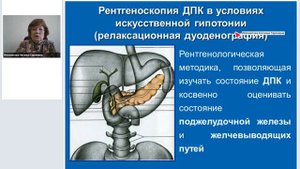 Рентгенологическое исследование двенадцатиперстной кишки.mp4