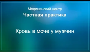Кровь в моче у мужчин