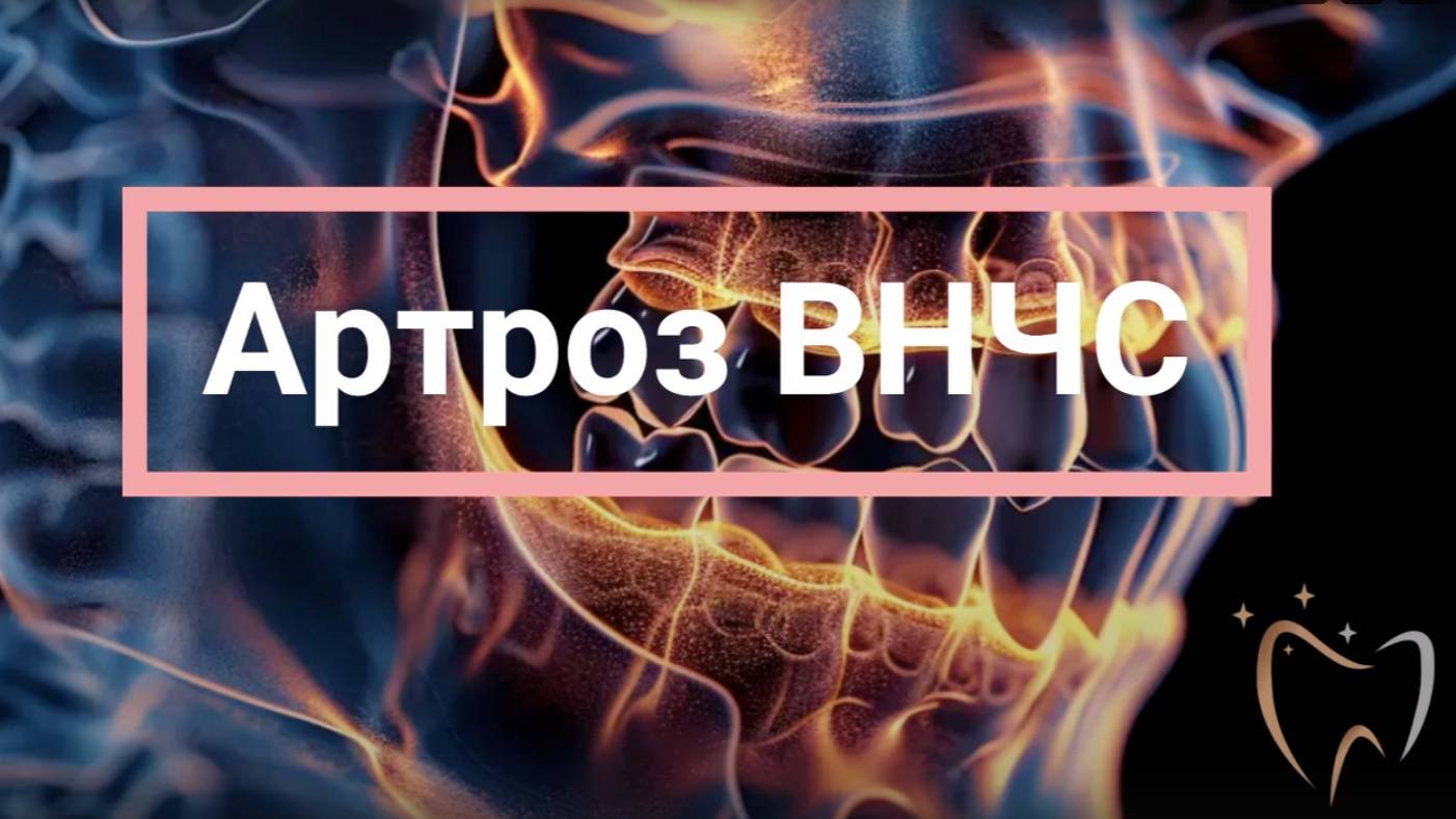 💥 Артроз ВНЧС