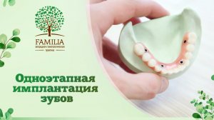 ? Одноэтапная имплантация зубов