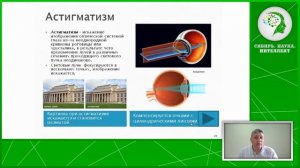 Астигматизм