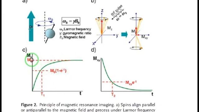 Imaging Techniques 18 - Magnetic Resonance Imaging (MRI) Part 1