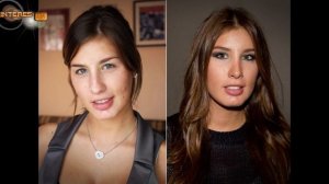 #35 Российские знаменитости До и После пластических операций
