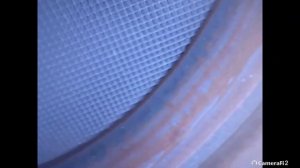 Hyundai i40 2.0 2018 29000км: эндоскопия катализатора