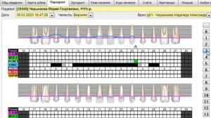 Заполнение Карты Пародонта в программе D4W