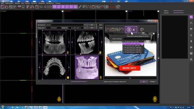 Загрузка и просмотр DICOM файла в Implastation. Урок 1 смотреть онлайн