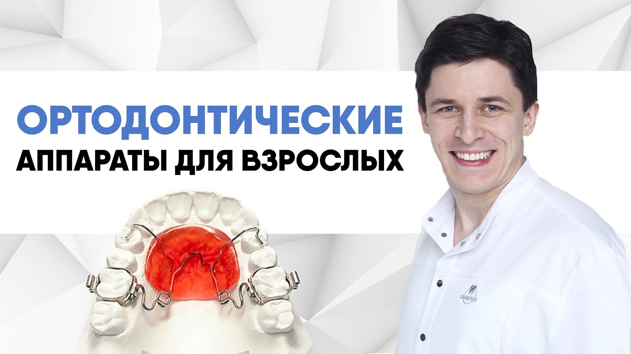 Аппараты для ортодонтического лечения [ микроимплантанты, Forsus, дуга Гожгариана, Pendullum ].