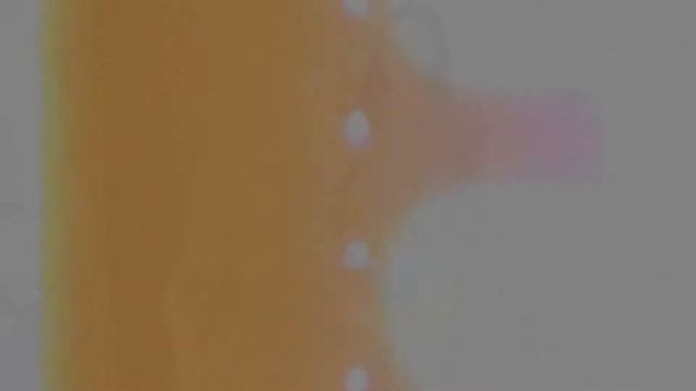 Убираем Попины Ушки