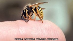 Укусила пчела — как снять опухоль