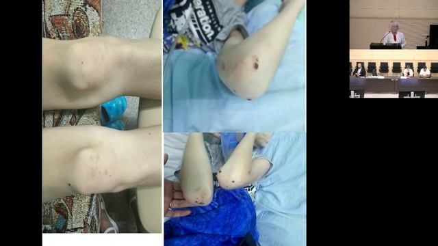 Актуальные вопросы детской кардиологии