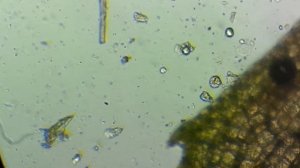 вода из аквариума под микроскопом