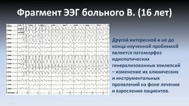 Эпилепсия у подростков и молодых взрослых