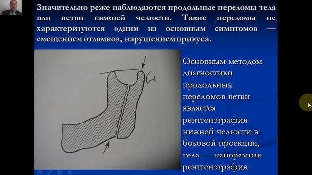 Изучить классификацию травм смотреть онлайн