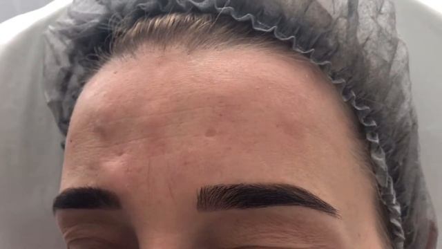 Индивидуальный курс обучения инъекционным методикам смотреть онлайн