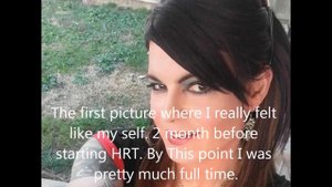 male to Female time line Pre-HRT to 5 Months  HRT