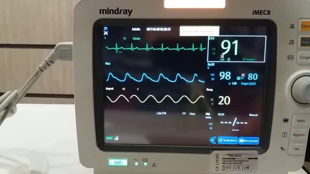 monitor de signos vitales imec 8 смотреть онлайн