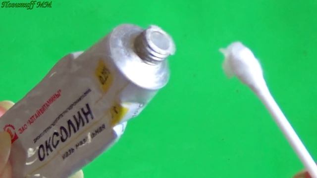 Папилломы ОТСОХНУТ! Копеечное АПТЕЧНОЕ средство для удаления папилломы. смотреть онлайн