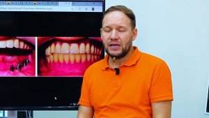 Хабиев Камиль Наильевич - базальная имплантация, тотальное восстановление зубов [Dental Guru]