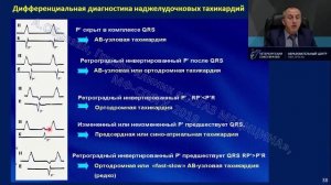 14.10.19 Электрокардиограмма анализ простых и сложных нарушений