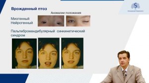 Заболевания вспомогательного аппарата глаза