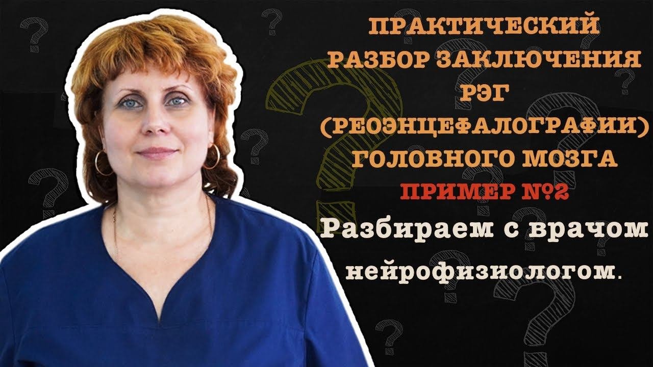 ПРИМЕР №2  ПРАКТИЧЕСКИЙ РАЗБОР ЗАКЛЮЧЕНИЯ РЭГ РЕОЭНЦЕФАЛОГРАФИИ ГОЛОВНОГО МОЗГА