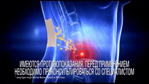 Реклама Пластырь Вольтарен - "Свобода движения!"