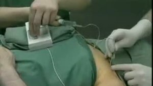 Надключичный блок