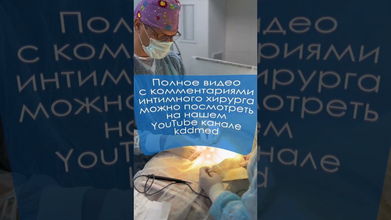 Бескровное обрезание. Физиологический фимоз в 20 #обрезание #shorts #фимоз #surgery #circumcision