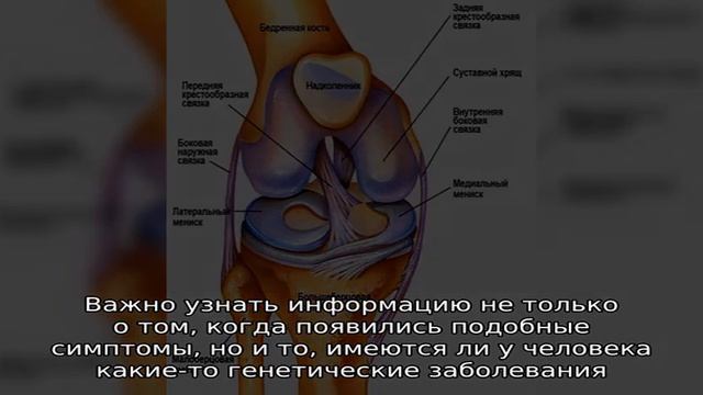 Гемартроз коленного сустава лечение. Гемартроз коленного сустава - причины, диагностика, лечение, последствия Гемартроз коленного сустава у взрослых: причины, симптомы, лечение. Гемартроз коленного сустава: причины и лечение :: SYL.ru