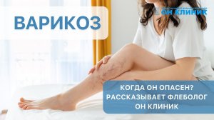 Варикоз. Когда он опасен?/рассказывает флеболог ОН КЛИНИК