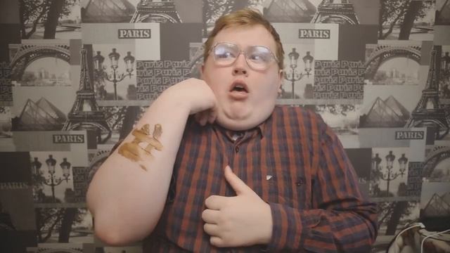 ИОДОВАЯ СЕТКА смотреть онлайн