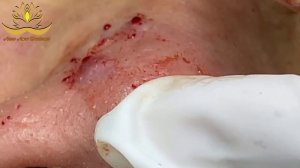 Most Satisfying and Relaxation with An Spa Video #095