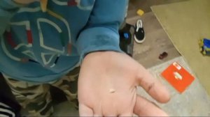 У Коли выпал первый зуб