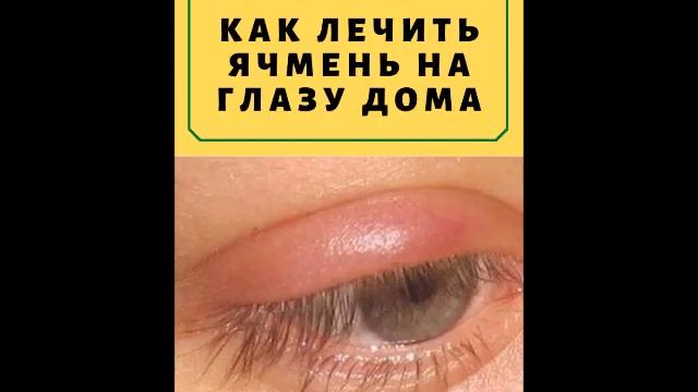 Роза Шпатель - глаз ячменный. смотреть онлайн