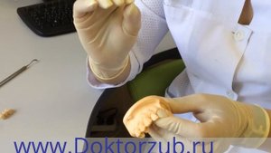 Коронки зубов из диоксида циркония - Современное протезирование зубов