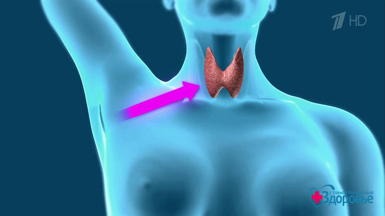 Видео железа. Операция щитовидной железы. Операция на щитовидную железу. Удаленная щитовидная железа.