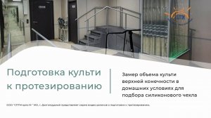 Замер объема культи верхней конечности для подбора силиконового чехла.