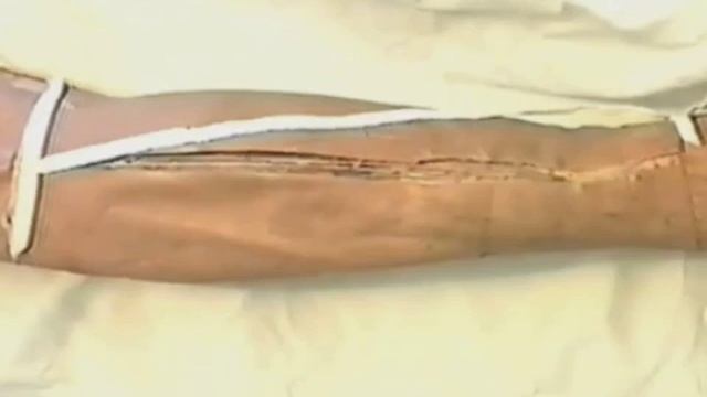 ОБЛАСТЬ ГОЛЕНИ - ДВГМУ смотреть онлайн