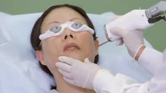 Melasma is treatable with Cutera enlighten laser смотреть онлайн