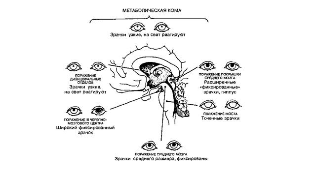 Диагностика и алгоритм неотложной помощи при коматозных состояниях у детей на догоспитальном этапе смотреть онлайн