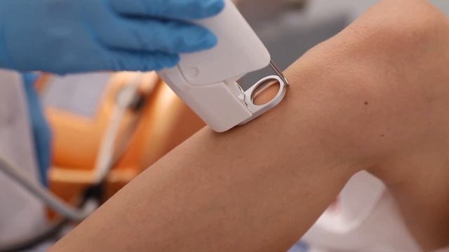 Лазерная эпиляция на аппарате Quanta System Duetto