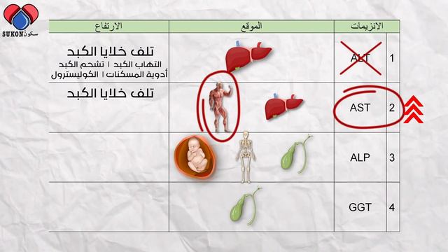 ماذا يعني ارتفاع إنزيمات الكبد  تحليل فحص صحة الكبد LFT